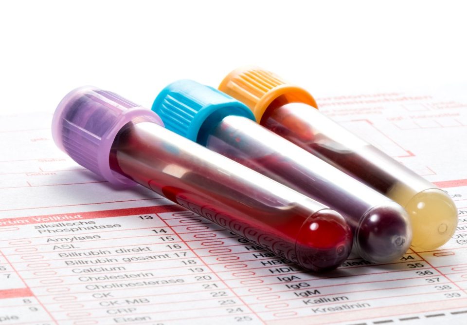 Jak często warto wykonać profilaktyczne badanie krwi